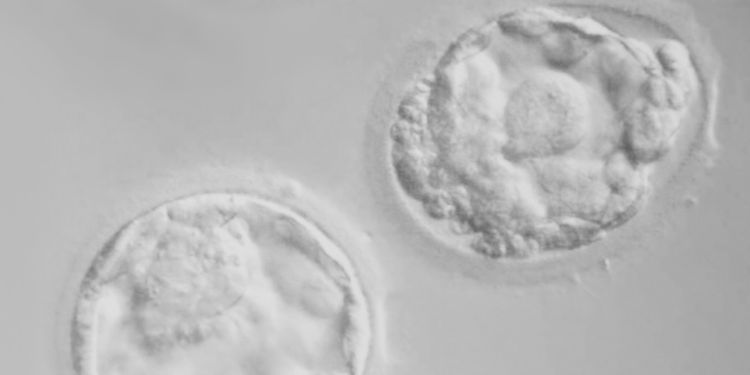 Microscopic photo of female egg fertilized
